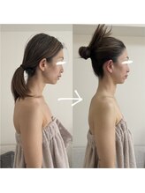 ルーナ 恵比寿(Luna)/首こり・ストレートネック改善