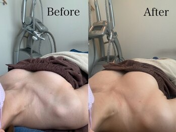 ジェイオー(J.O)/バストアップコルギ/小顔コルギ