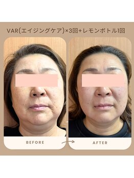 ルームエイトエイティスリー 新宿(R883)/エイジングケア×レモンボトル