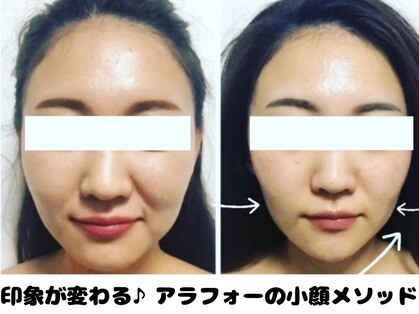 ラクタイセイタイイン 梅田茶屋町店(楽体整体院)の写真