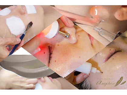 アンジェロの写真