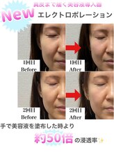 ミムー/before／after