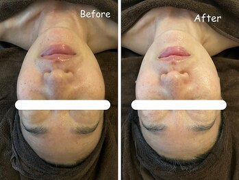 レイ(REI)/◆リフトアップ◆