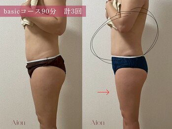 アイオン(Aion)/basicコース90分 計3回での変化