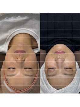 ミヨン(Miyong)/40代/顔の大きさが気になる