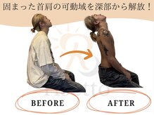 リセット鍼灸院(Risetto鍼灸院)/正しい姿勢は背中から！