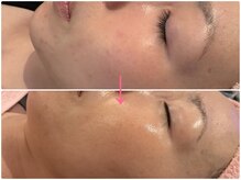 ビューティーエディットラボ(Beauty Edit Lab)/頬の赤みが気になる方に◎