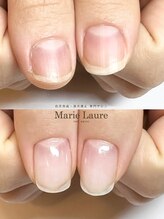 マリーロール 梅田店(Marie Laure)/自爪育成/深爪矯正/ネイルケア