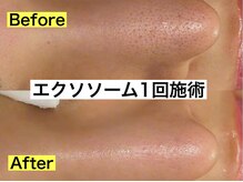 メルディアナ(MAR DIANA)の雰囲気（たった一回の施術で衝撃の効果を栃木県で味わえるのは当店のみ◎）