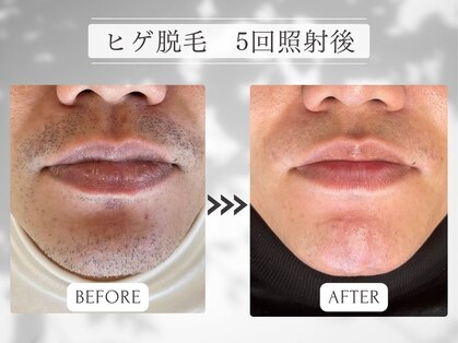 ル リエン(Le lien)の写真
