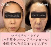 ブリエ(brille)
