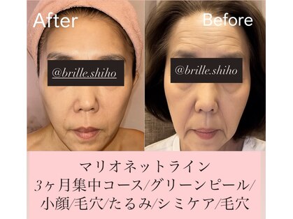 ブリエ(brille)の写真