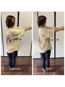 ミントのかべの整体院/施術ビフォーアフター