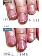 ネイルケアタイム メディカルセンター川越店(NAIL CARE TiME)/自分で爪の形上手く削れない、、