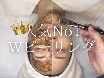 アイビーケア 三田(ivy care)の写真/40代からのシミ再発予防ケアに◎シミケアには肌質改善・再生・修復ケアを。