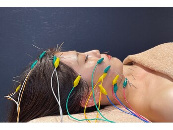 ウル(ulu)/電気を流す美容鍼