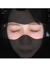 テセラ(Tethere)/目元分析