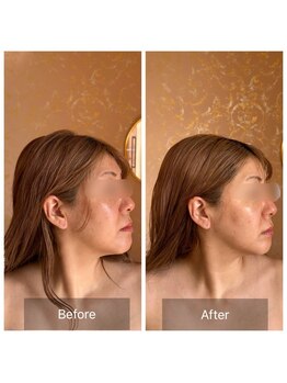 コンジュ(kongju)/コルギ