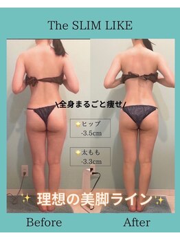 スリムライク 鳥取店(The SLIM LIKE)/痩身ビフォーアフター