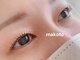 ねこの王子様。の写真/《下がりまつげ、逆さまつげの解消に！》自まつ毛が少ない、短い、細い、少ない等のお悩みもお任せ♪
