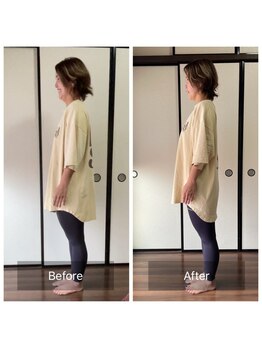 ミントのかべの整体院/施術ビフォーアフター