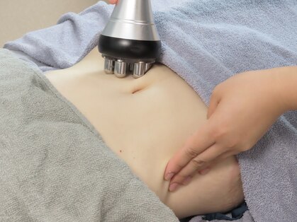ヴィコロン(Vicolone)の写真