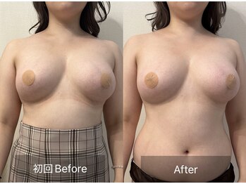 ルメール(Lemaile)/ダイエット 痩身　バストアップ