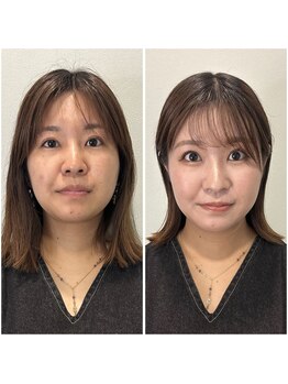 モンド 駒込店(monde)/婚活メイクレッスン