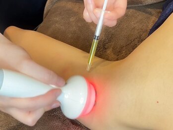 スマイルビューティラボ 別府店(Smile Beauty lab.)の写真/【レモンボトル痩身導入サロン☆】二の腕や背中のハミ肉を集中ケアし、スッキリ理想のボディラインへ♪