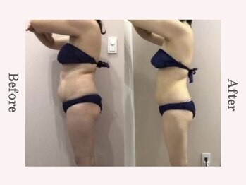 ビューティースタジオ エイワン(A1)/