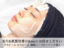 アンドミー 神戸元町店(&me)の雰囲気（今話題ララピール◎【ハーブピーリング/ニキビケア/毛穴洗浄】）