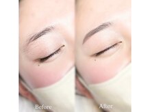 シュエール(Chuaile)/ハリウッドブロウリフト