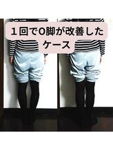 ベルフィオーレ/１回でO脚が改善したケース