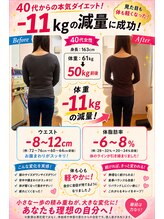 美容整体スズキ(SUZUKI)/驚きの変化