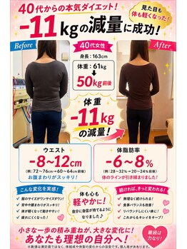 美容整体スズキ(SUZUKI)/驚きの変化