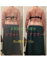 リズ(Liz)/短期集中ダイエット