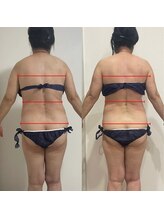 シュエットプラス(Chouette+)/セルゼロ2