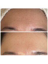 サロンドシー(SALON de C.)/くすみ・ごわつき改善