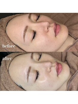 ルミナス(Luminous)/ララピール