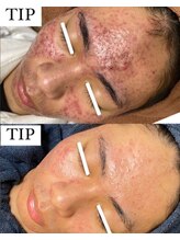 プランス 熊本(PLANCE)/男女問わずご相談ください。