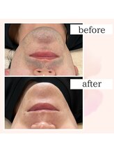 ブランルピナス(Blanc Lupinus)/