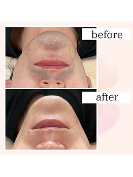 ブランルピナス(Blanc Lupinus)/