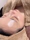 いごこちいい場所 ほのほのの写真/不要な角質の溜まった状態が原因で引き起こすシミやくすみにアプローチ！肌質改善して艶々の潤い肌に★