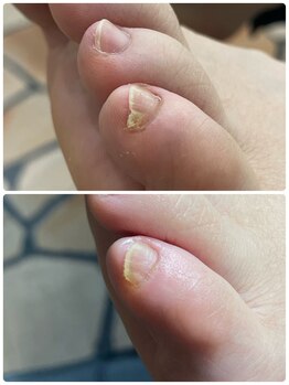 クーラ アンド ベリッシモ(Cura&Bellissimo)/フットケア