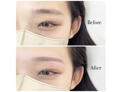 エルブリンク(elblink)の写真