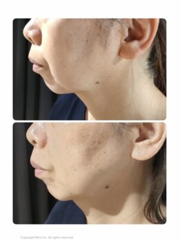 ソラ(sola*)/レモンボトル