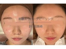 ライフサロン 天神(Life Salon)/エイジングケア