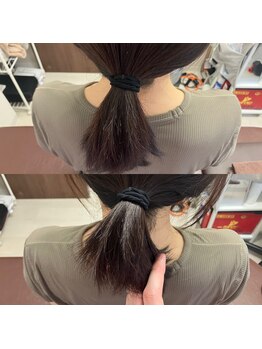 とるこり美姿整体院 新宿院/巻き肩改善Before/After