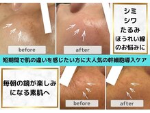 アンマンドの雰囲気（もう遅いなんて諦めていた自分に自身を！）