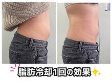 リアウェイク(Reawayke)の雰囲気（30代のお客様BeforeAfter1度の施術で驚きの効果が！！）